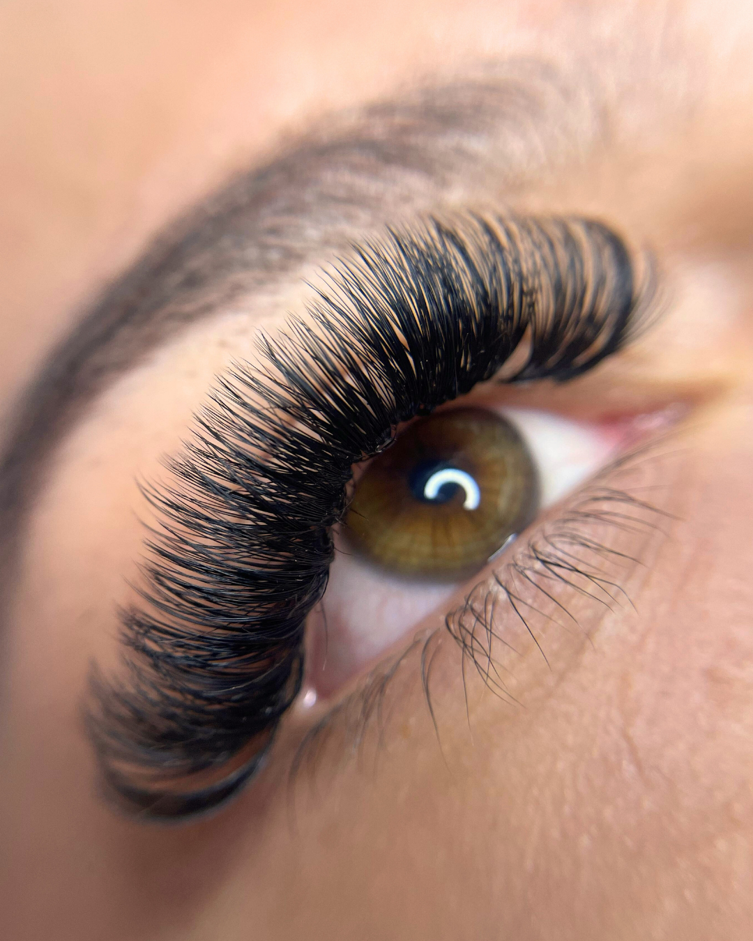 CILS - Rehaussement + Extensions